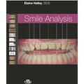 Smile analysis. Ediz. italiana