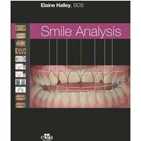 Smile analysis. Ediz. italiana