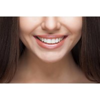 2, 4, 6, or 8 Teeth Composite Bonding at Revive Clinic, London | Wowcher