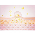 LED Therapy Cap For Hair Growth-LED & Laser Standard