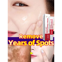 Removal Melasma Dark Spots Whitening Freckles Face Cream Corrector Lighten Melanin Pigmentation Brighten Anti-Aging Beauty Care