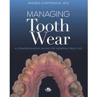 Managing tooth Wear. A comprehensive guide for general practice